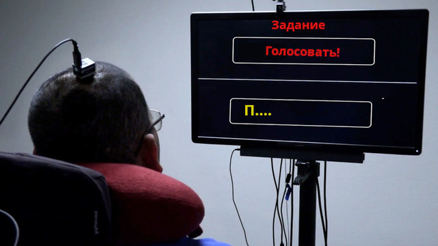 Имплант