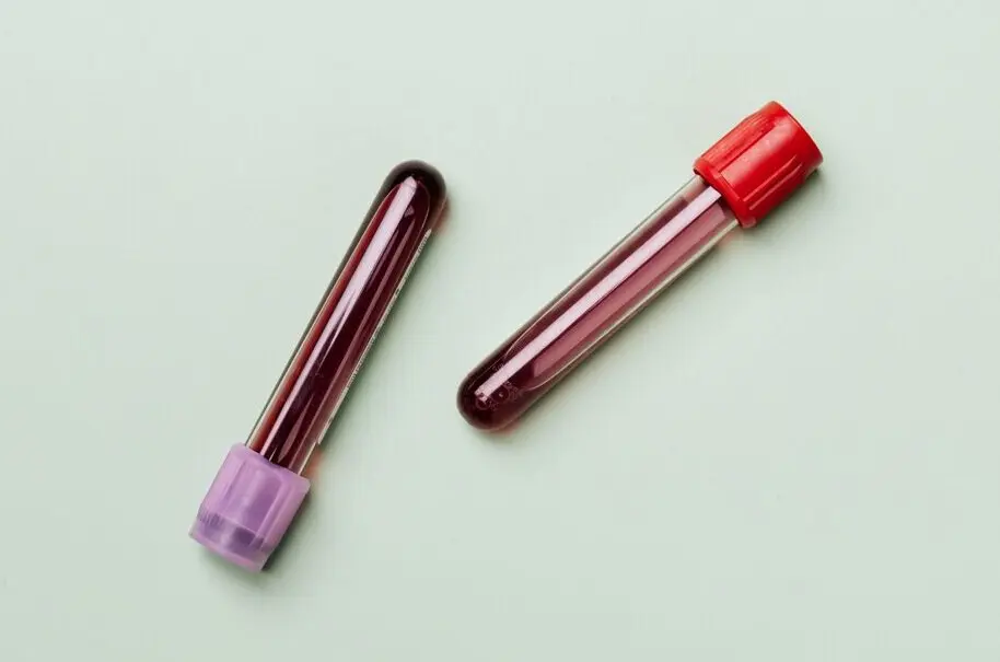 New Blood Biomarkers Indicate Early Cognitive Decline Linked to Alzheimer's Disease