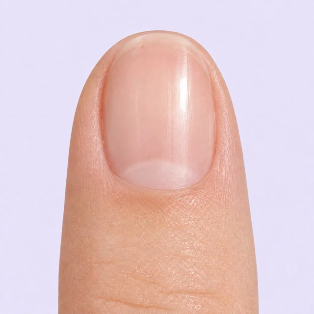 Cuticle after using the VELLUVA pen