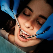 Sydney-dental-implant-prices