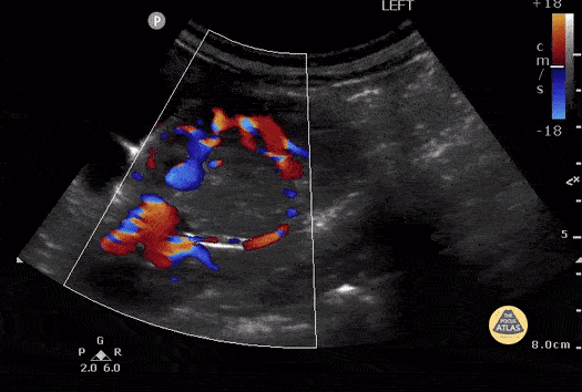 penile doppler ultrasound