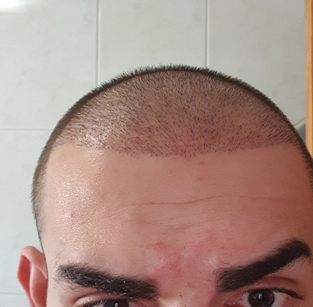 10 días después
