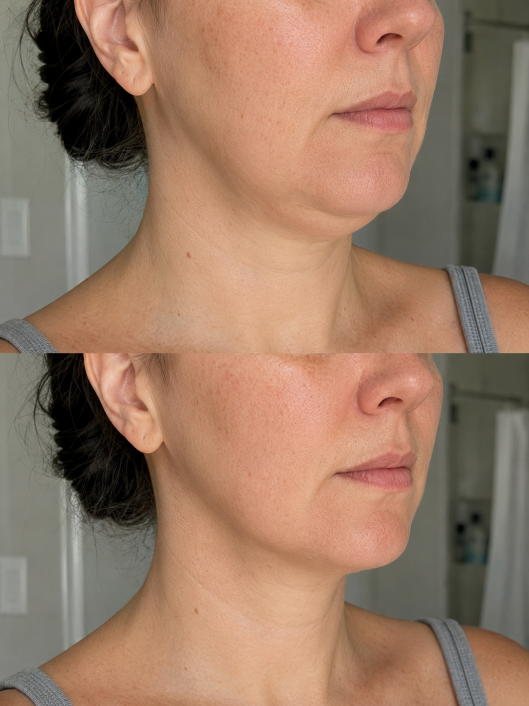 Antes y después rostro