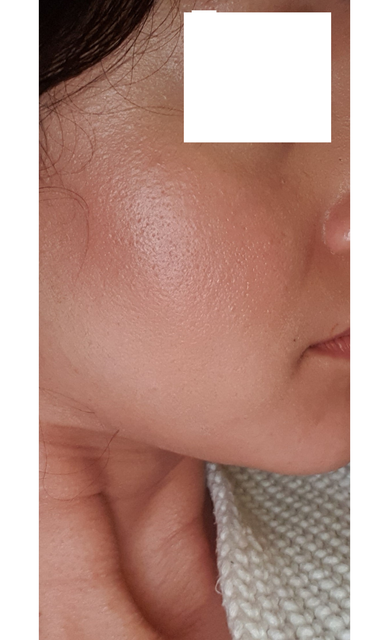 Skin-4