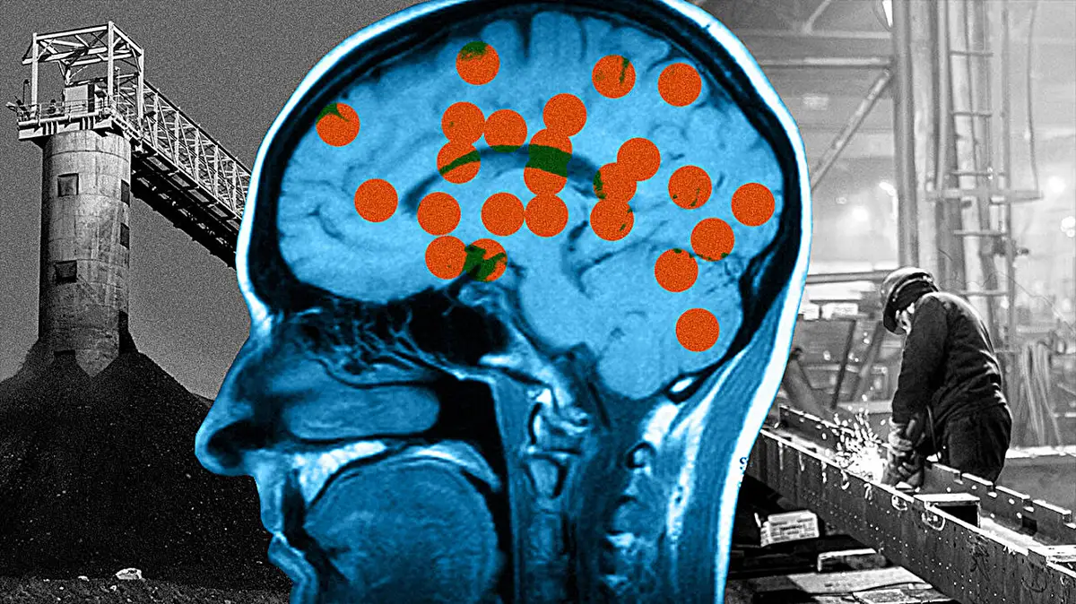 Manganese Removal Linked to Brain Barrier Protein