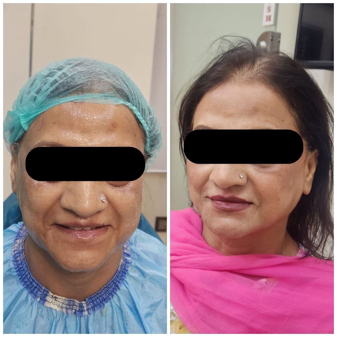 Real patient result