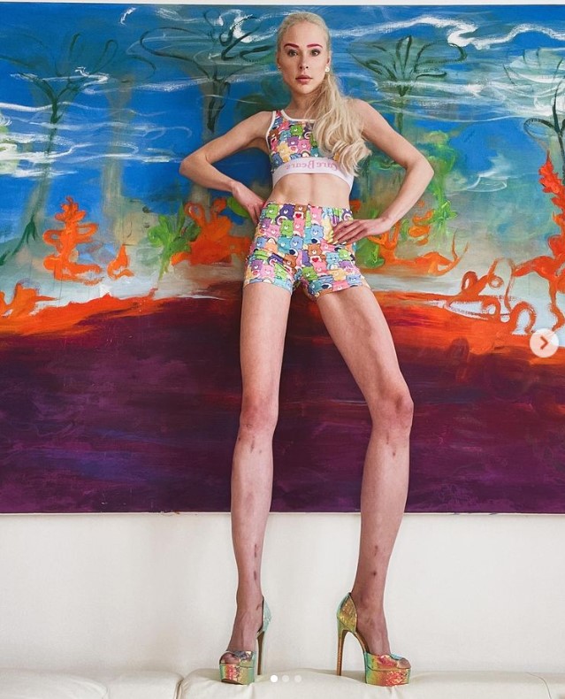 German model did LL with Dr. Becker