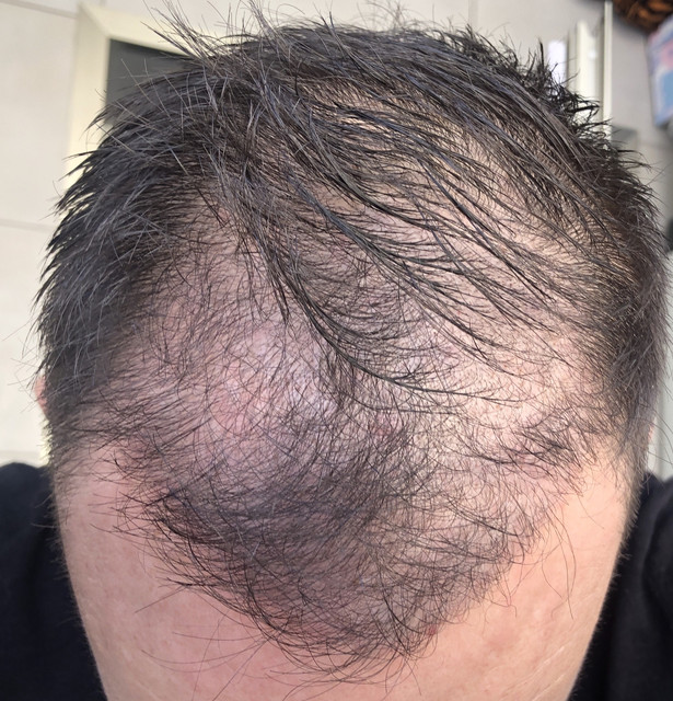 Pelo mojado