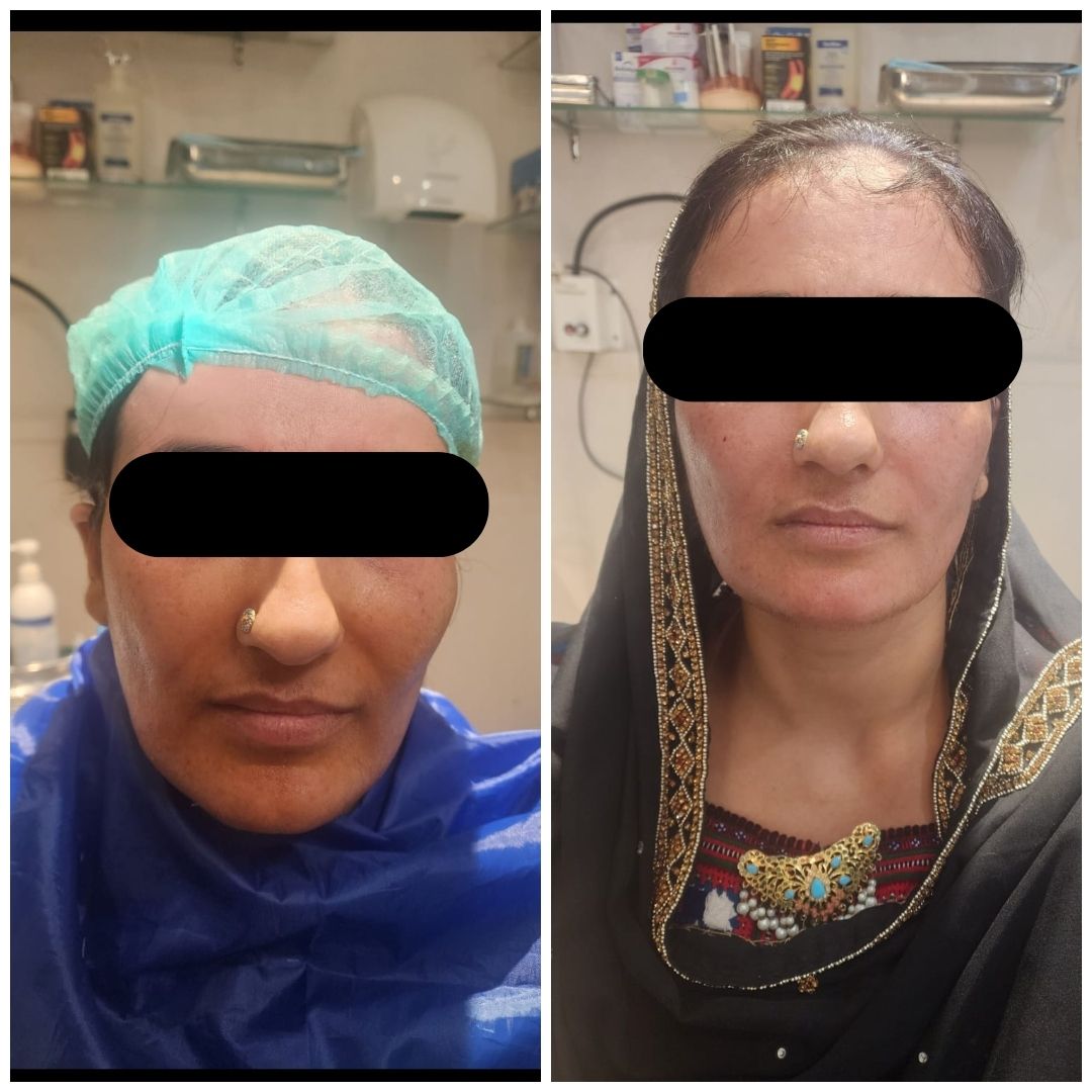 Real patient result