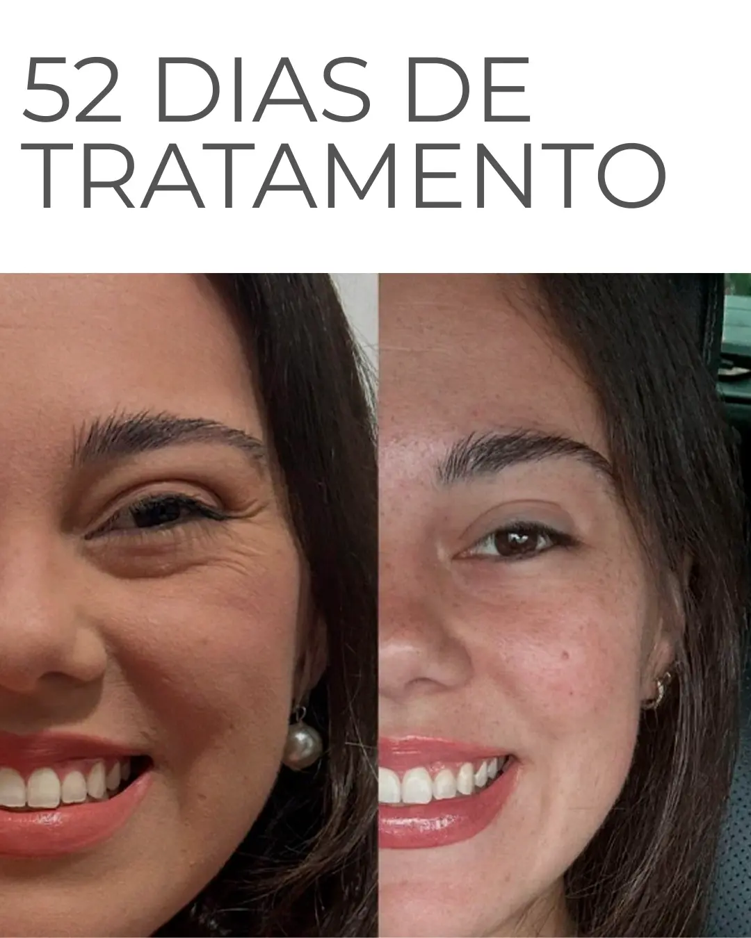 Gabriela, 30 anos