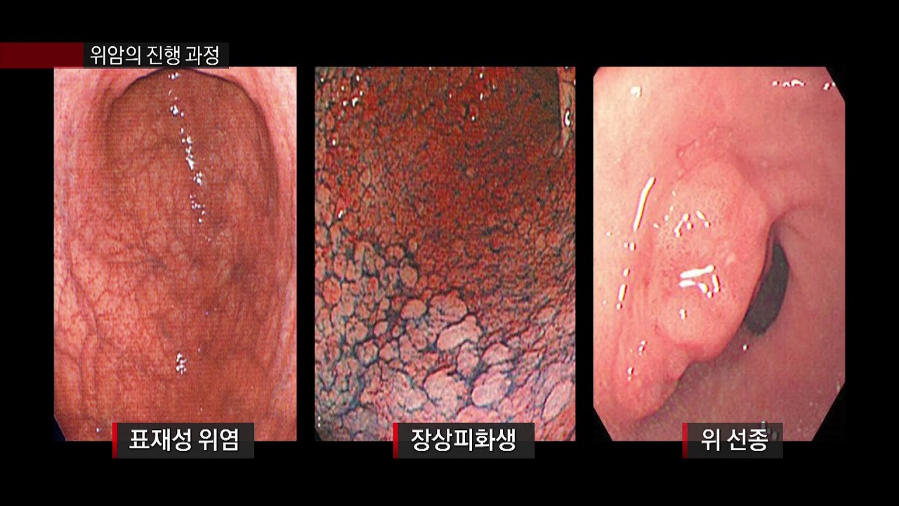 본문이미지