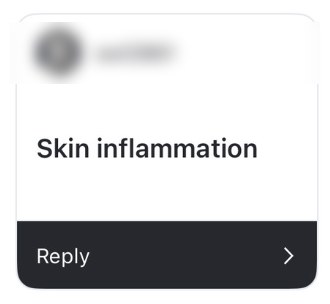 Story reply