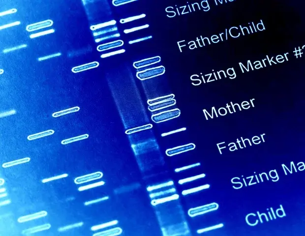 Rare Oral Cancer Genetic Signature Discovered