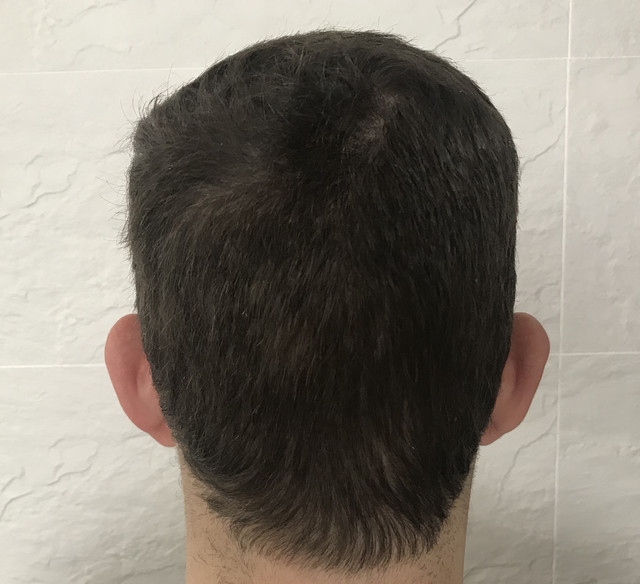 IMG 5491