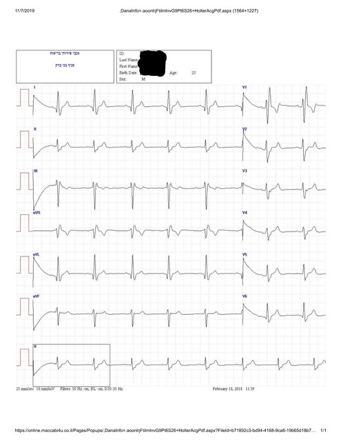 ECG