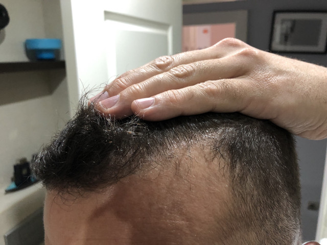 frontal-1