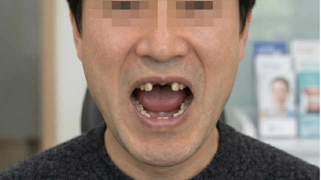 수술 전