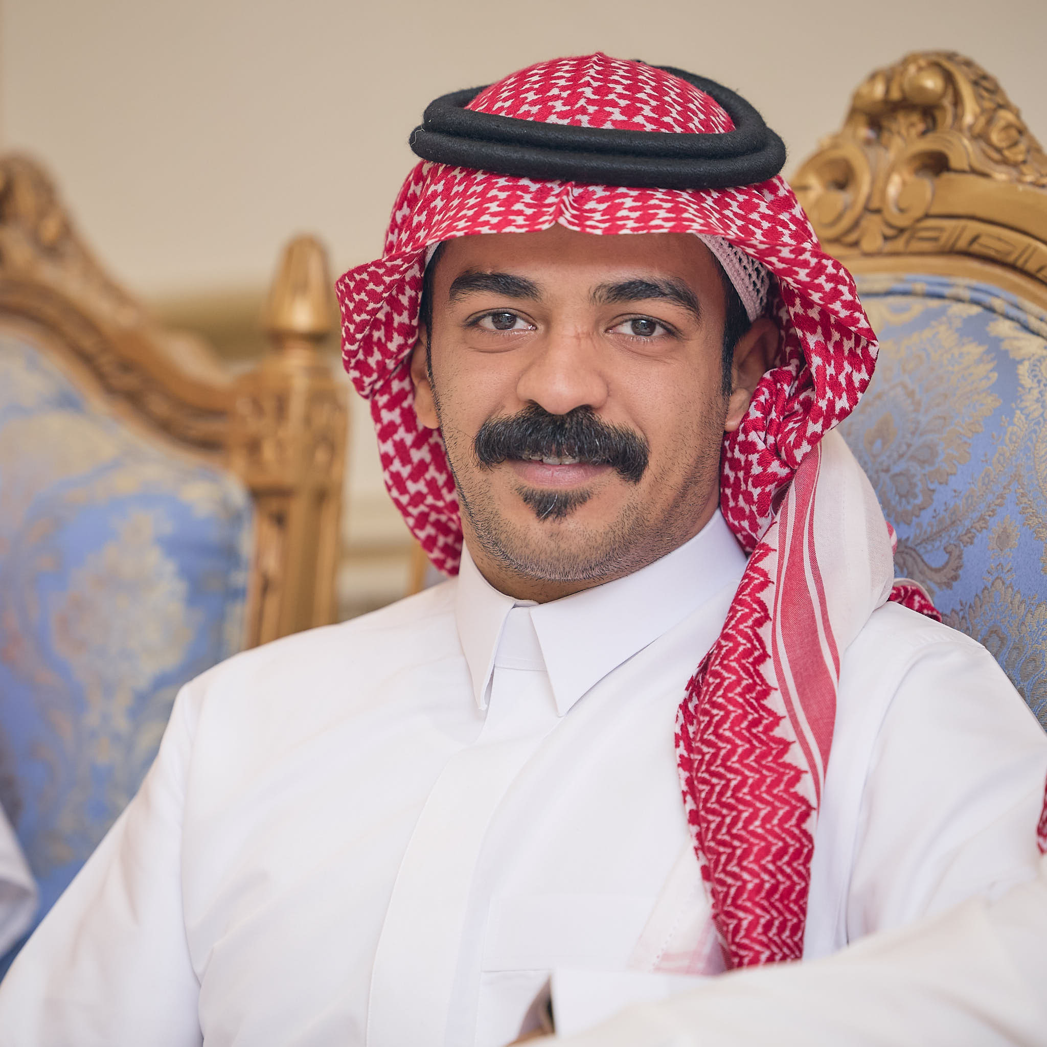 RMC20723