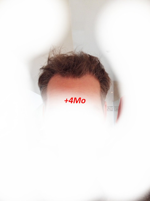 4Mo-2.jpg