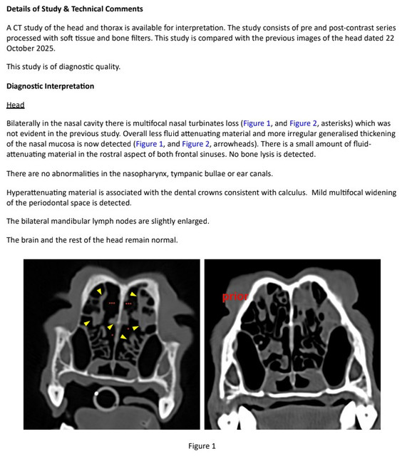 CT2