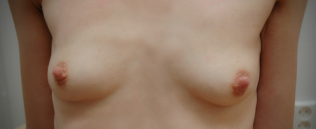 %IMAGE_DESCRIPTION%