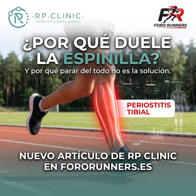 Periostitis tibial: por qué duele la espinilla y por qué parar del todo no la arregla