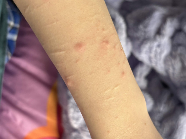 skin arm