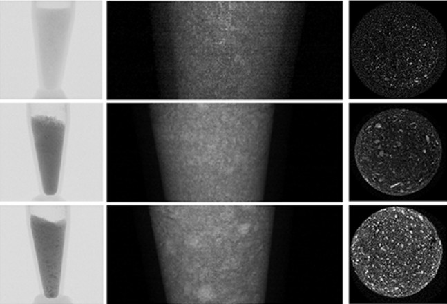 Radiopacity endowed magnetic nanocomposite with hyperthermia and i in vitro i mineralization potential: a combinatorial therapeutic system for osteosarcoma