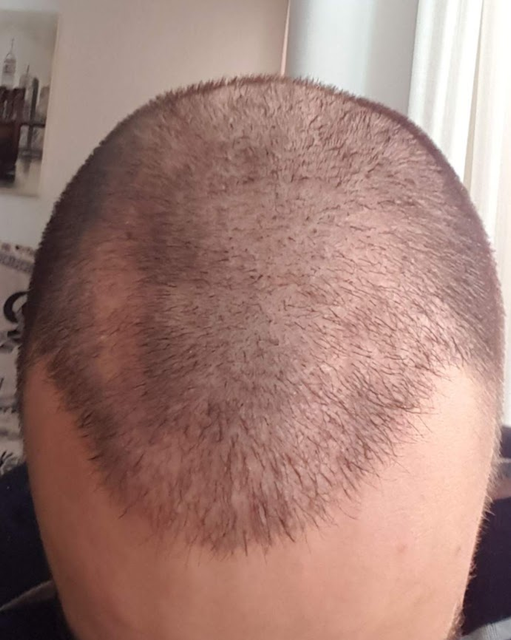 6 meses.png