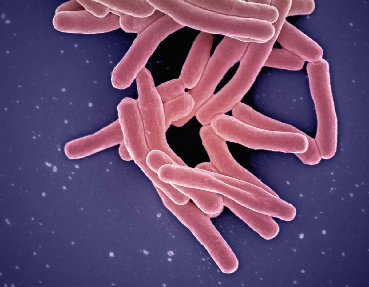 Early Detection of Tuberculosis through Finger-prick Blood Test