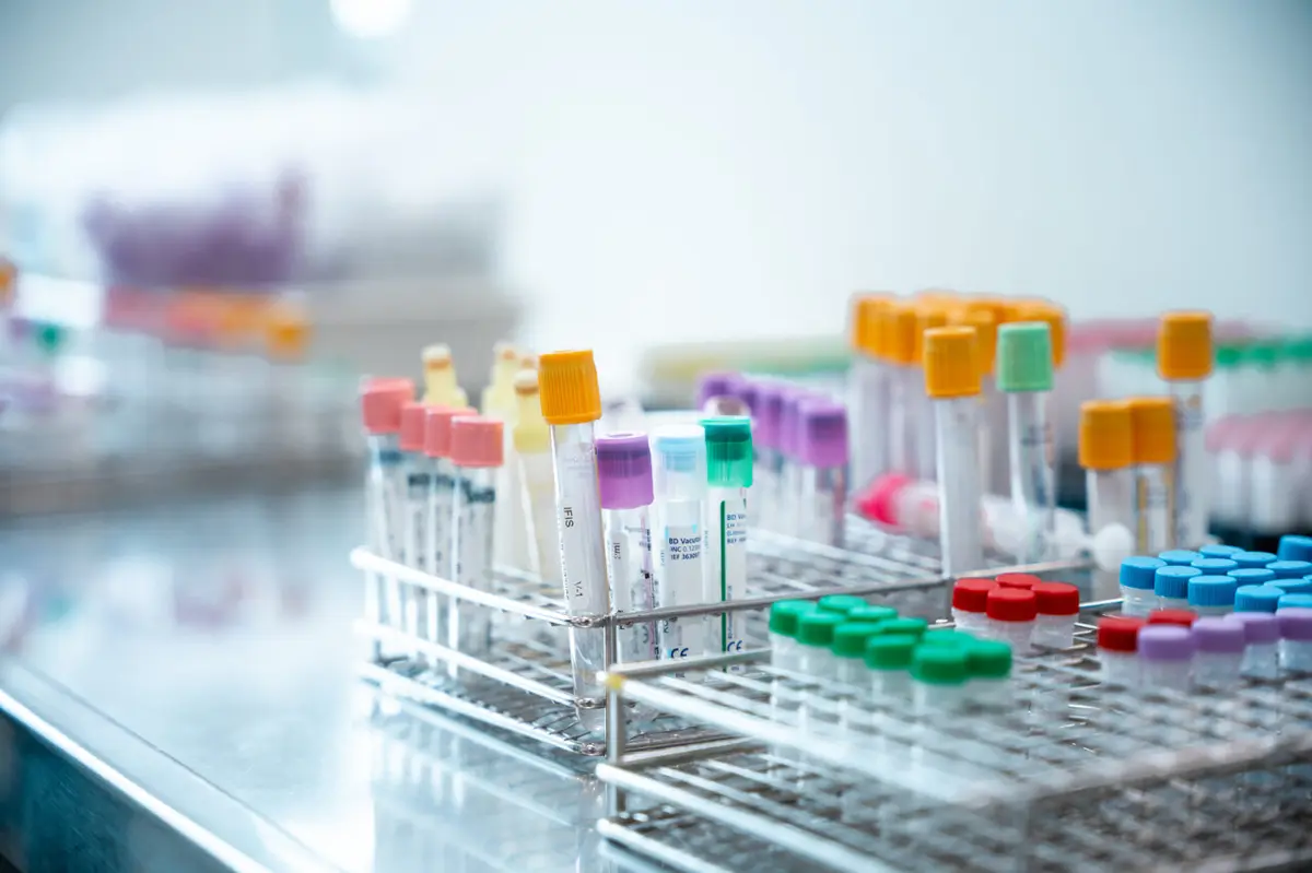 Early Glucagon Surges Linked to Fatty Liver Disease in Type 2 Diabetes Patients
