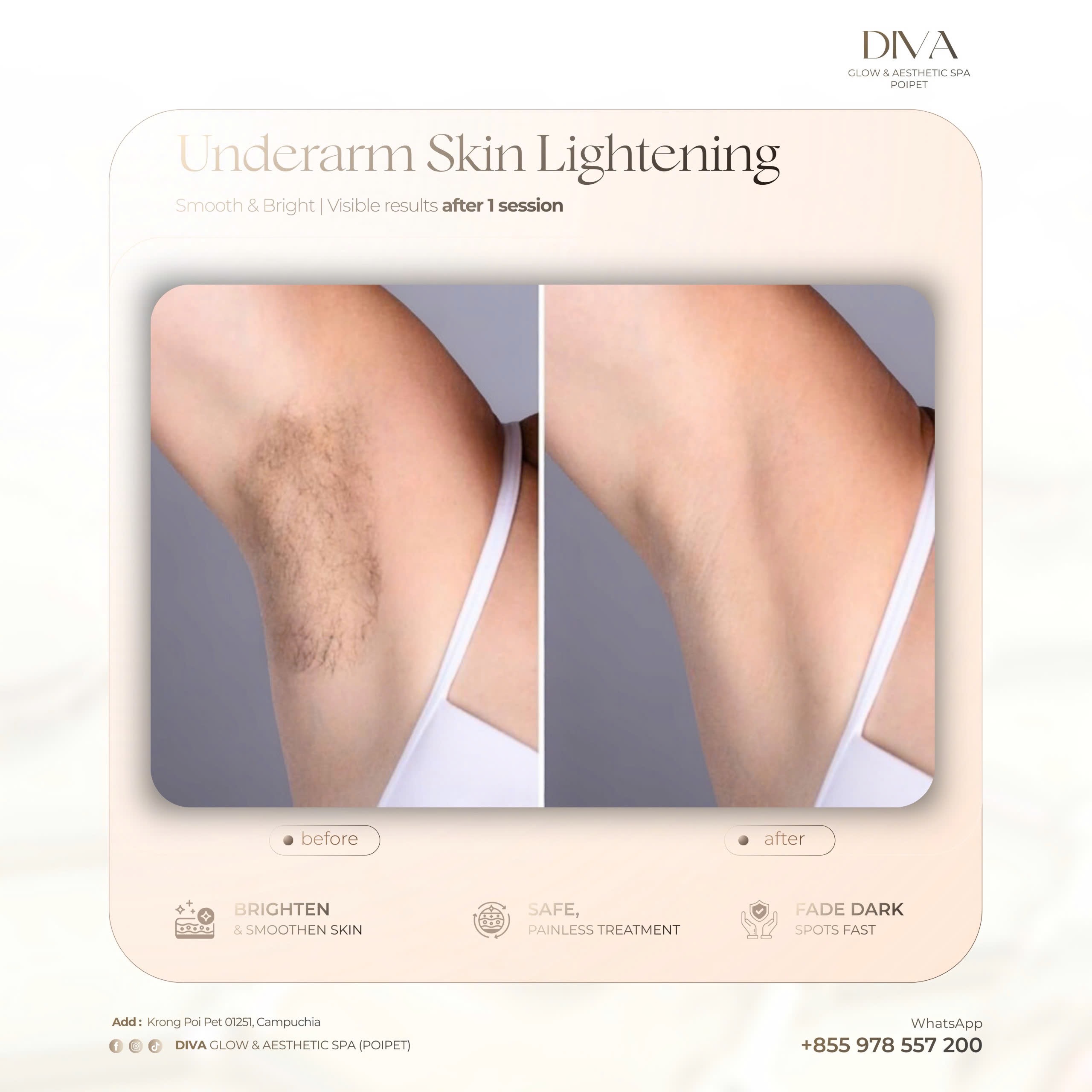 DIVA Skin Clinic Poipet
