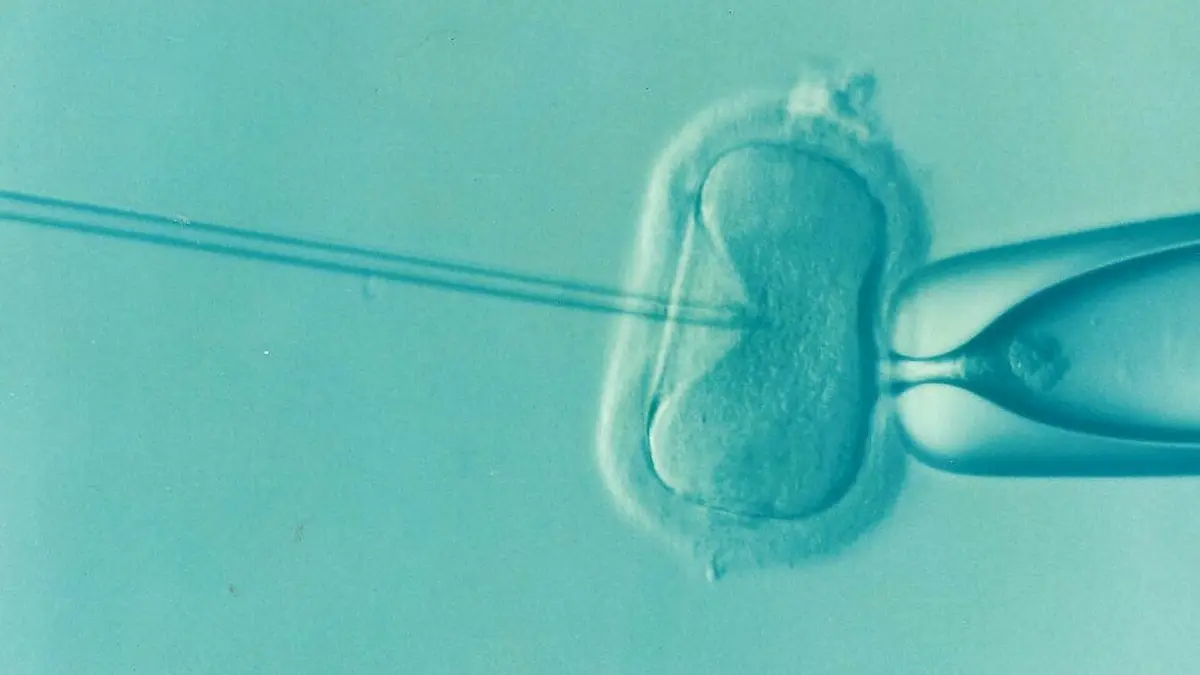 IVF Extras Lack Evidence of Boosting Fertility