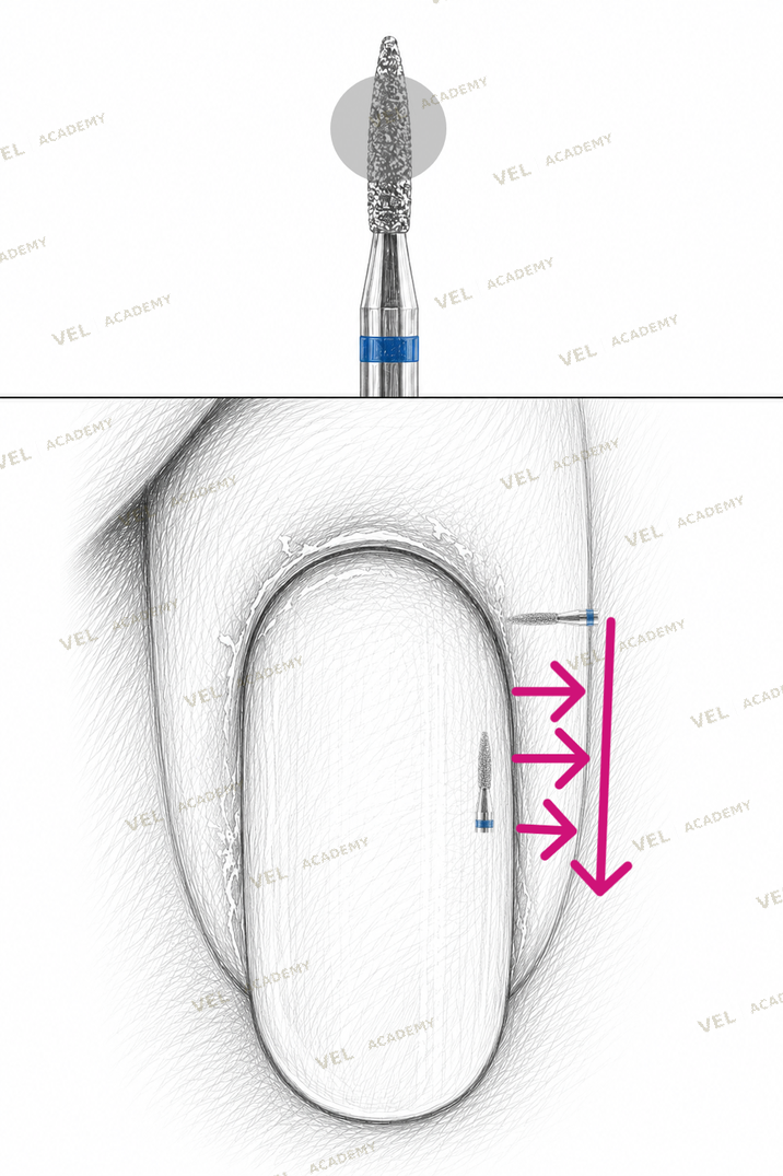 REW step 4 removing dryness right ridge belly of bit