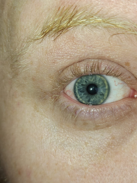 eye