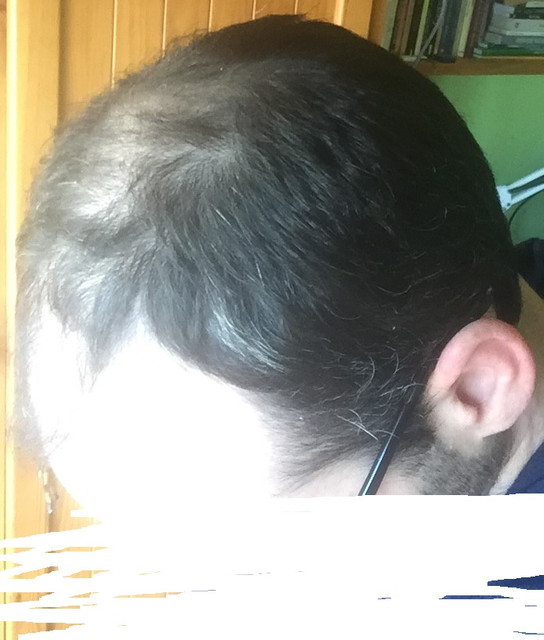calva4