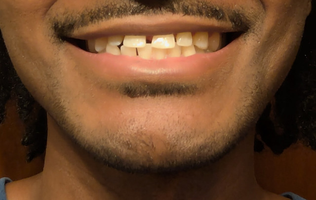 1000002663