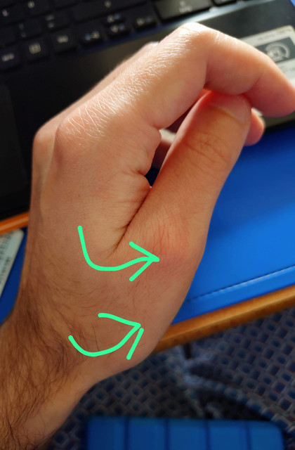 hand 2