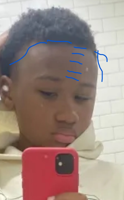nohairline