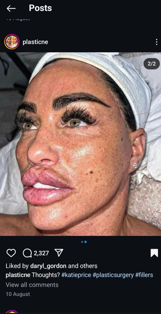 Fishface