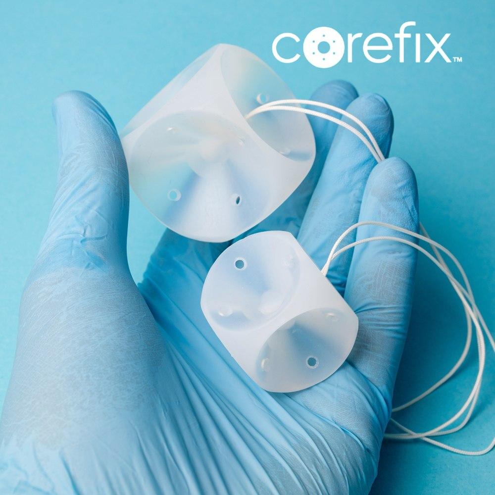 Песарій Кубічний Corefix®