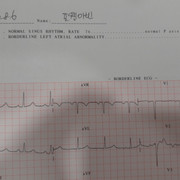 Heart Exam 2