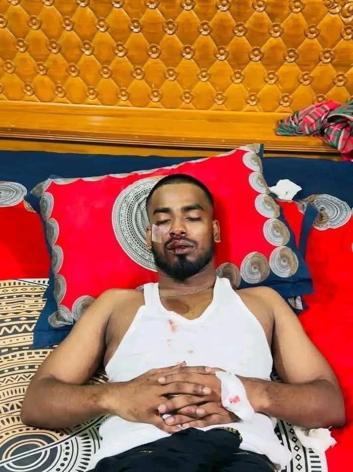Former Bangladesh Chhatra League (BCL) leader Al-Amin Akash critically injured after a sudden political attack in Tangail.