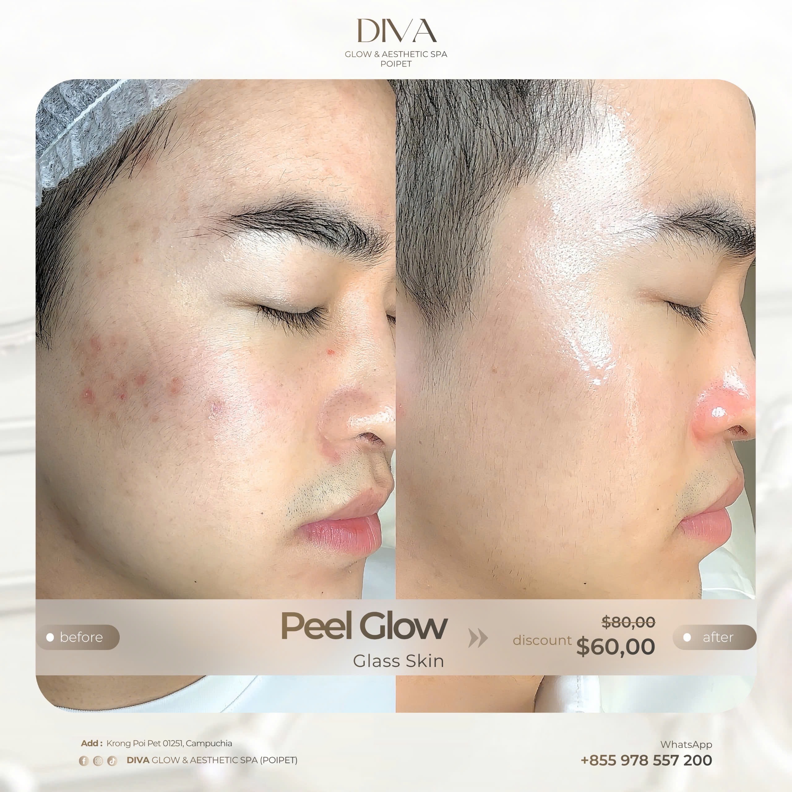 DIVA Skin Clinic Poipet
