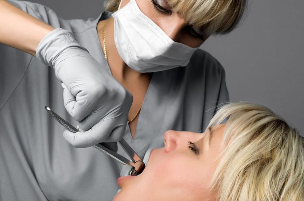 Facts You May Not Know About Wisdom Tooth Extraction