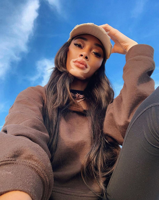 Winnie-Harlow-3.jpg