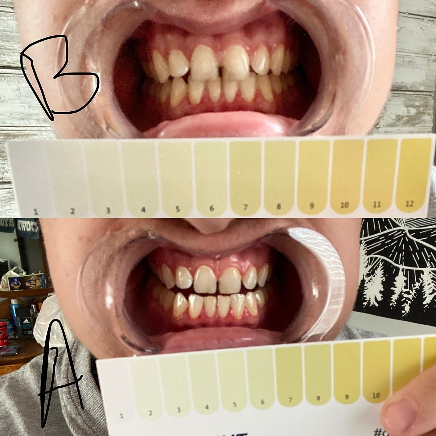 Resultado Dr. Dent - Isabella S.