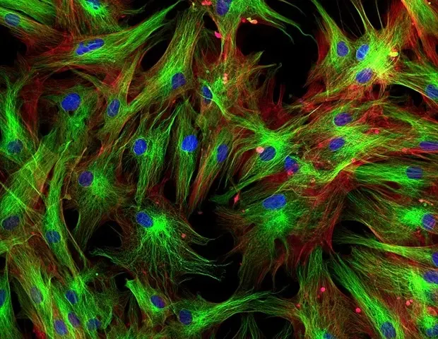Key Mechanism Behind Chronic Sjögren's Disease Uncovered