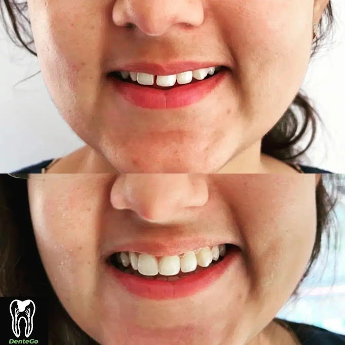 Clinical Dental Treatment at DenteGo
