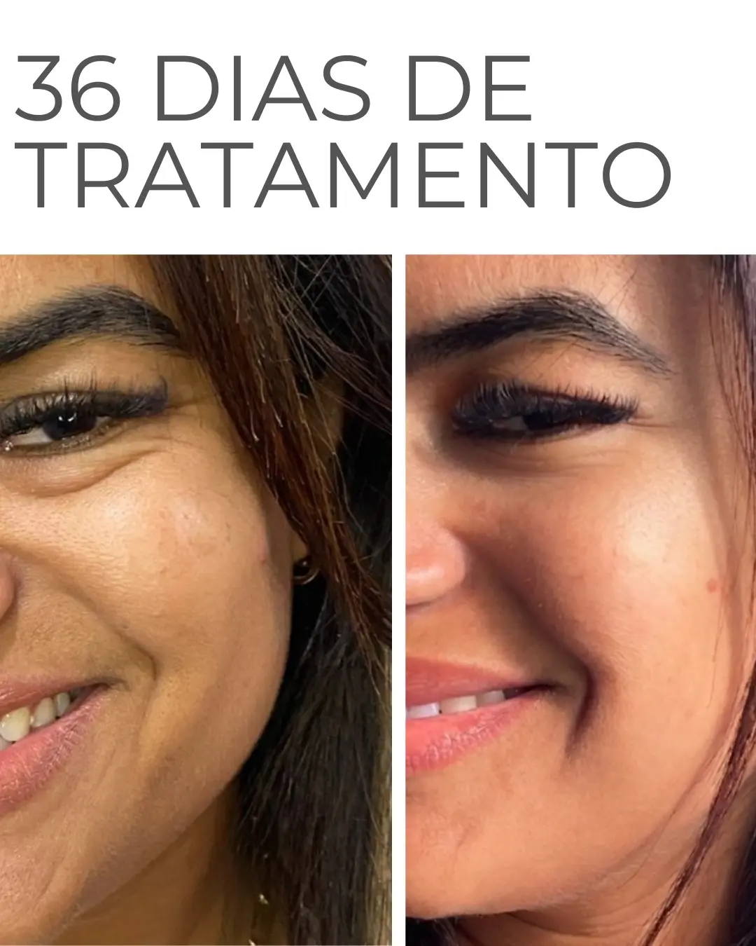 Patrícia, 38 anos